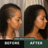 DENSIPLEX™ • Batana Oil